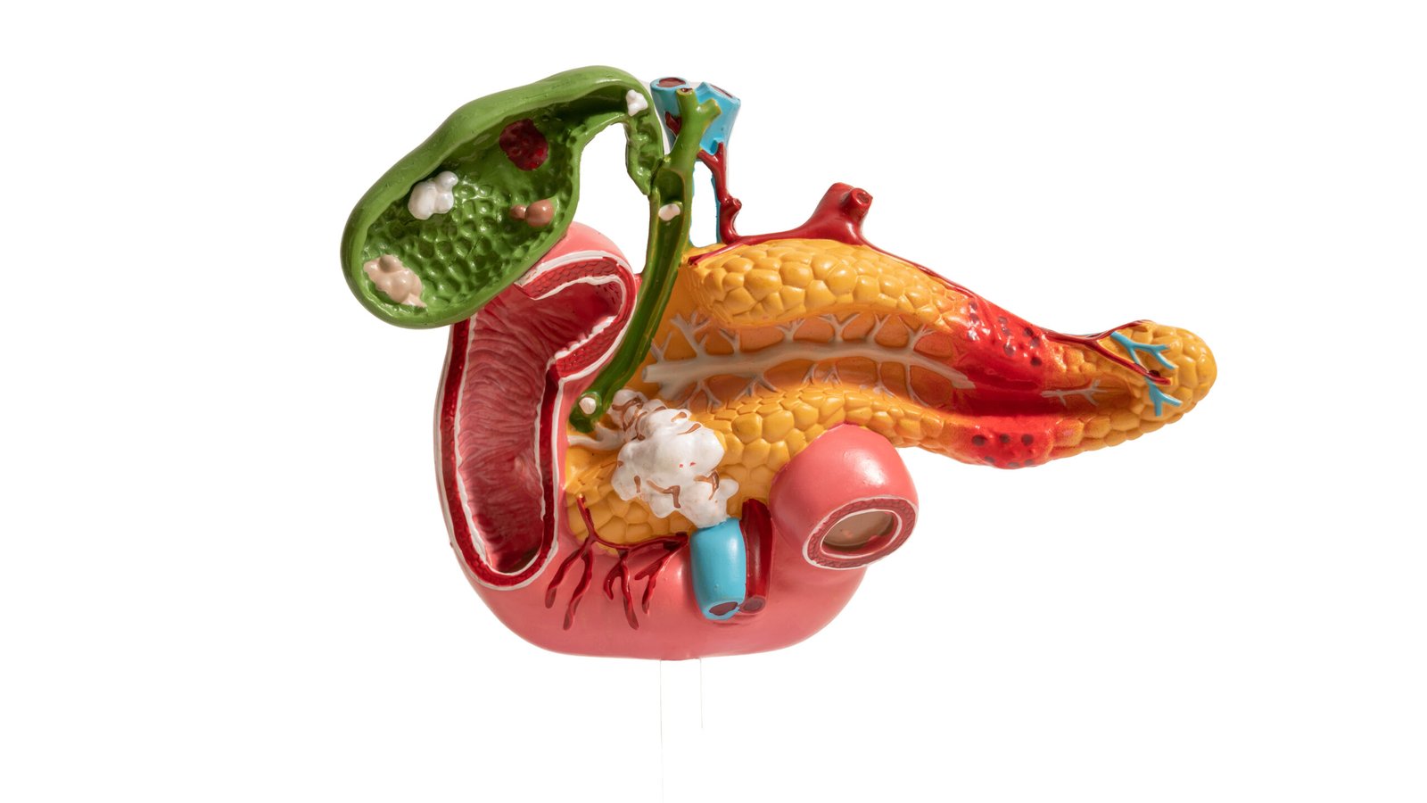 Pankreas adalah salah satu organ pencernaan manusia yang sering kali luput dari perhatian. Padahal, organ ini punya peran vital dalam membantu tubuh mencerna makanan, terutama karbohidrat, protein, dan lemak. Pankreas memproduksi enzim-enzim yang bekerja keras untuk mengurai makanan jadi nutrisi yang bisa diserap tubuh. Nggak cuma itu, pankreas juga punya tugas penting lainnya, yaitu memproduksi insulin, yaitu hormon yang berfungsi mengatur gula darah.